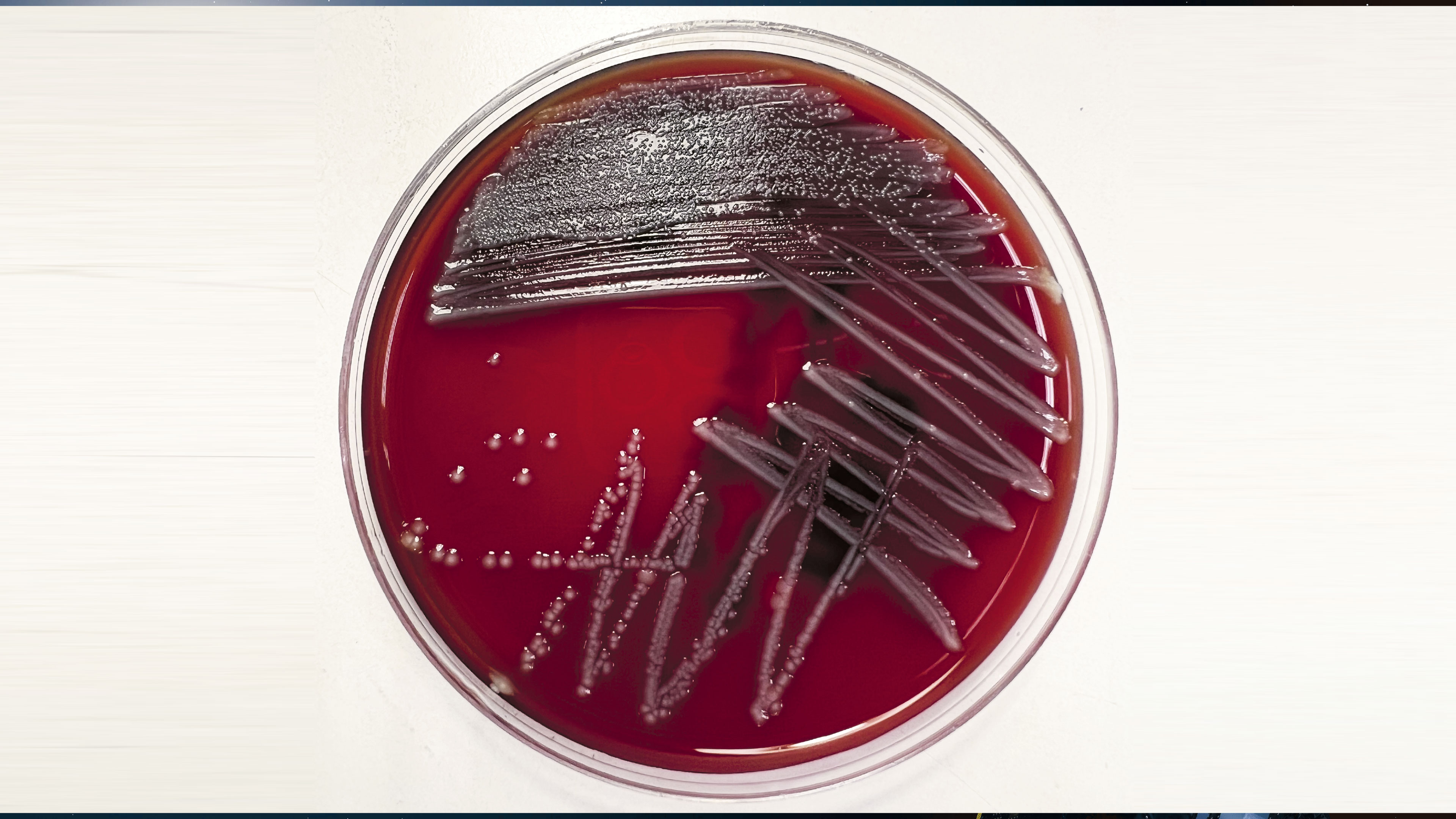 Una bacteria de interés en los hospitales”